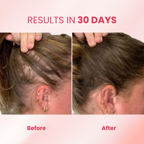 INTENSE SCALP STIMULATING BRUSH